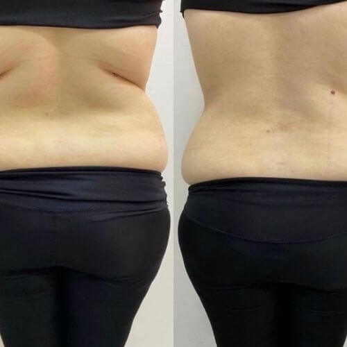 Serpil Gün Hizmetler Bölgesel İncelme Bölgesel Zayıflama